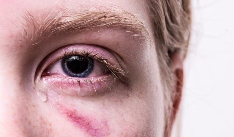 Merasa Terbayang Masa Lalu Yang Kelam? Berikut 3 Cara Menghilangkan Trauma