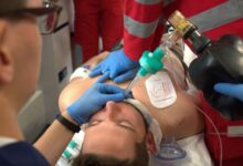 cpr 9180856 1280 e1748070862263